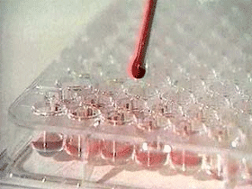 Кровь. фото с сайта Ural.Ru Кровь. фото с сайта Ural.Ru