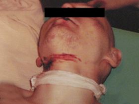 Избитый заключенный Избитый заключенный