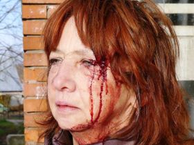 Избитый наблюдатель Наталья Подзорова. Фото Виктора Шамаева, Каспаров.Ru Избитый наблюдатель Наталья Подзорова. Фото Виктора Шамаева, Каспаров.Ru