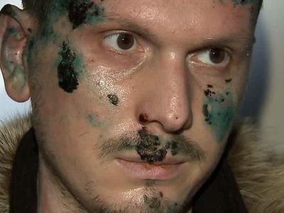 Адам Осмаев. Фото: gazeta.ru Адам Осмаев. Фото: gazeta.ru