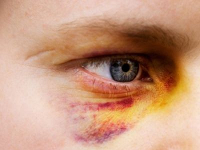 Избиение Фото: vutare.ru Избиение Фото: vutare.ru