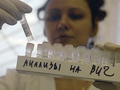 ВИЧ-инфекция. Фото: media-polesye.by ВИЧ-инфекция. Фото: media-polesye.by