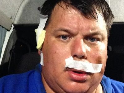 Избитый журналист. Фото Василия Стрельцова, Каспаров.Ru Избитый журналист. Фото Василия Стрельцова, Каспаров.Ru