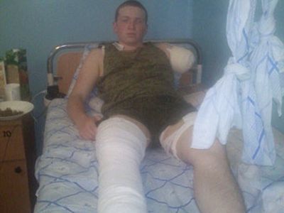 Изувеченный солдат. Фото: предоставлено Каспаров.Ru родными Изувеченный солдат. Фото: предоставлено Каспаров.Ru родными