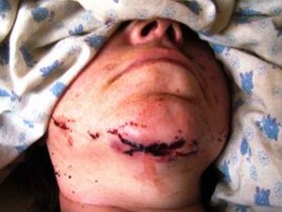 Суицид. Фото: Виктор Надеждин, Каспаров.Ru Суицид. Фото: Виктор Надеждин, Каспаров.Ru