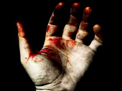 Окровавленная рука. Источник - cdn.minval.az Окровавленная рука. Источник - cdn.minval.az