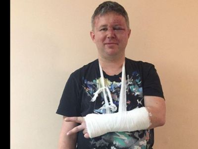 Избитый Динар Идрисов. Фото: facebook.com/DinarSpbRu Избитый Динар Идрисов. Фото: facebook.com/DinarSpbRu