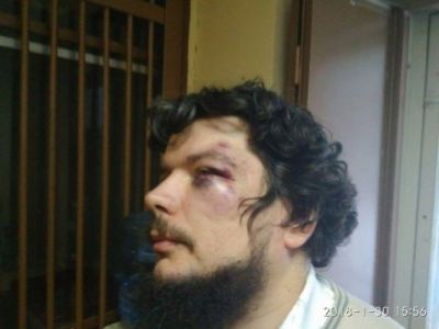 Избитый юрист Валентин Карелин. Фото: ovdinfo.org Избитый юрист Валентин Карелин. Фото: ovdinfo.org