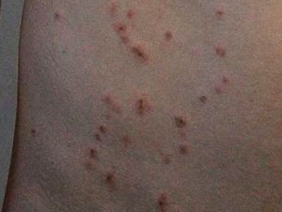 Пытка током. Фото: "Коммерсант"