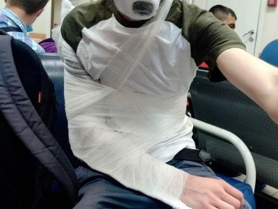 Сломанная рука. Фото: Ombudsmanspb.ru Сломанная рука. Фото: Ombudsmanspb.ru